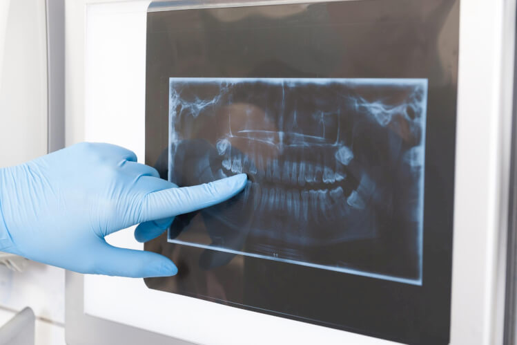 Your Oral Surgeon: A Dental Health Care Specialist