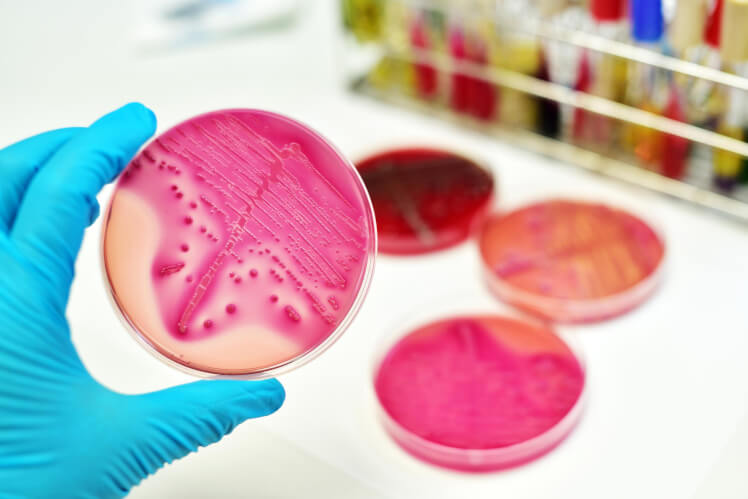 Sepsis: What Do You Need to Know?