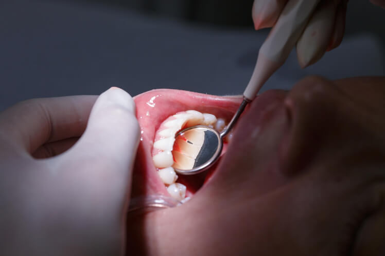 Your Periodontist: An Oral Health Care Specialist