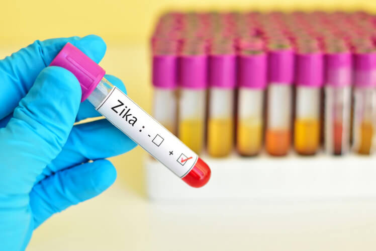 Zika Virus: What Do You Need to Know?